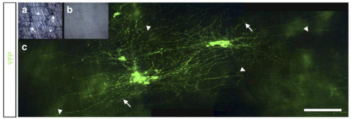 Confocal micrograph of stem cells transplanted into a mouse's gut.