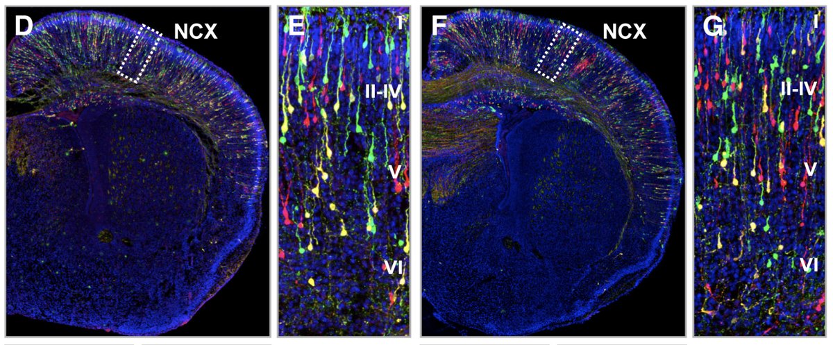 Confocal micrographs of MADM mouse tissue in a control (left) and Lgl-/+ (right) mice.